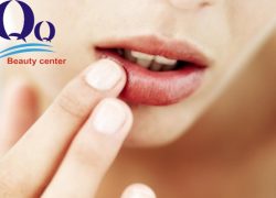 Bí kíp loại bỏ bờ môi thâm hiệu quả