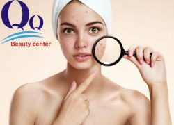 Các cách điều trị mụn mủ hiệu quả